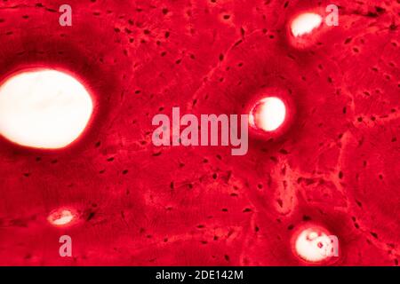 Human compact bone tissue, light micrograph Stock Photo