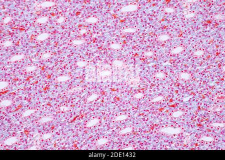 Human kidney, light micrograph Stock Photo