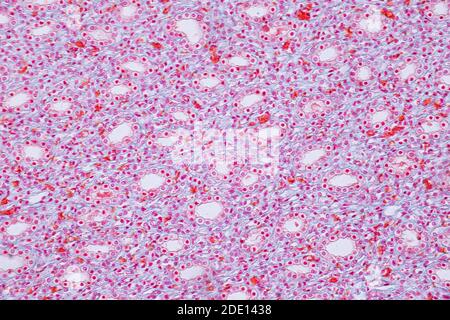 Human kidney, light micrograph Stock Photo