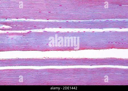 Human skeletal muscle, light micrograph Stock Photo