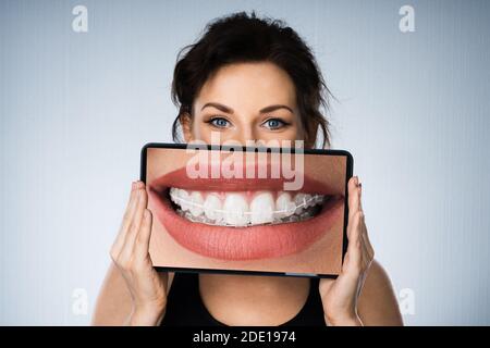 Fund Woman Portrait With Dental Braces And Tablet Stock Photo