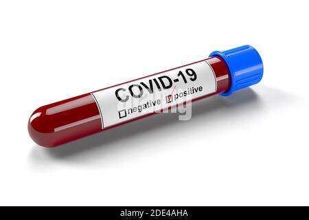 Test tube with blood sample positive Rabies virus, 3D rendering Stock ...