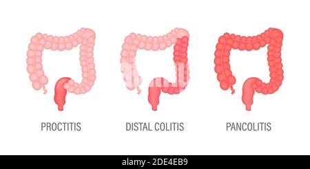 Colitis for medical design. Gastroenterology. Gut constipation icon design. Health care. Vector stock illustration. Stock Vector