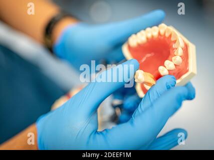 Dental prosthesis, dentures, prosthetics work. Prosthetics hands while working on the denture. Stock Photo