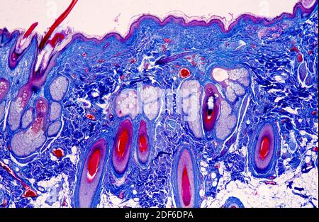 Human skin showing hairs, sebaceous glands and connective tissue. Cross ...