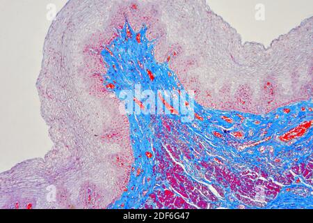 Human esophagus or oesophagus showing squamous epithelium stratified ...