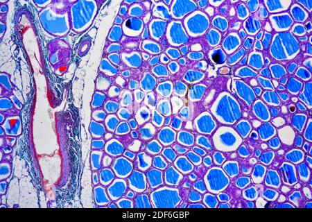 Human thyroid gland showing follicles, endothelial cells and follicular ...