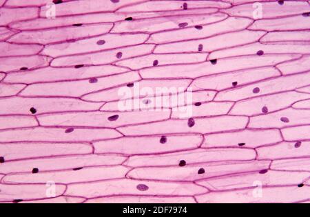 Epidermis of onion (Allium cepa) with cells, nucleus and walls ...