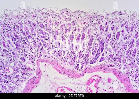 Fundic region stomach (cross section) showing mucosa, submucosa ...