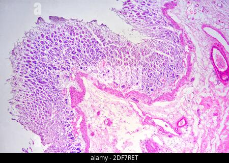 Fundic region stomach (cross section) showing mucosa, submucosa ...