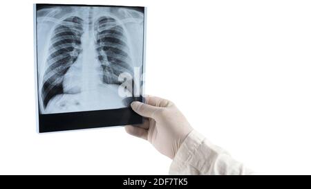 X-ray of human lungs isolated on white background space for text and inscription, picture of lungs with right for inscription Stock Photo