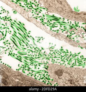 Colorized transmission electron micrograph of Ebola virus particles (green) found both as extracellular particles and budding particles from chronical Stock Photo