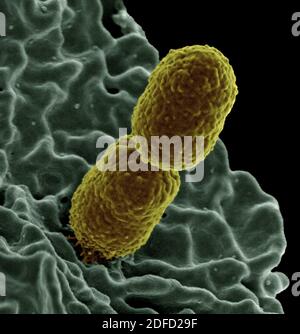 Colorized scanning electron micrograph showing carbapenem-resistnt Klebsiella pneumoniae interacting with a human neutrophil. Stock Photo