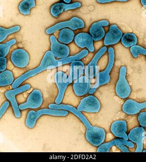 Colorized transmission electron micrograph of Marburg virus particles (blue) harvested from infected VERO E6 cell supernatant. Image captured and colo