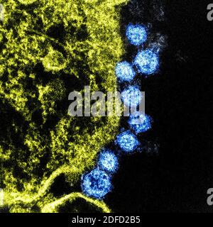 Colorized transmission electron micrograph of Middle East Respiratory Syndrome virus particles (blue) found near the periphery of an infected VERO E6 Stock Photo