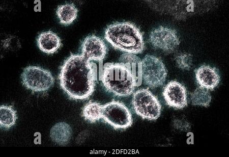 This transmission electron microscope image shows SARS-CoV-2, the virus that causes COVID-19, isolated from a patient in the U.S. Virus particles are