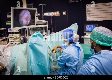 H.O.L.E.P (Holmium laser enucleation of the prostate) prostate enucleation and fragmentation of bladder stones, Holmium laser treatment of prostate ad Stock Photo
