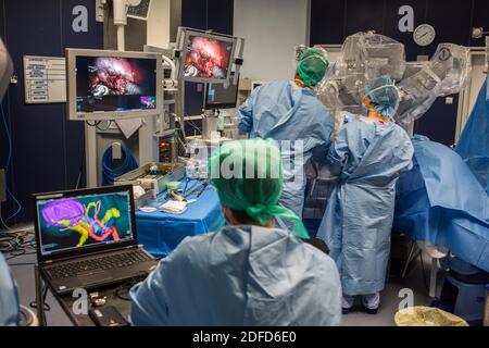 Image-guided robotic conservative renal surgery assisted by 3D modeling, This 3D modeling of the kidney with its tumor located in purple, guides the s Stock Photo