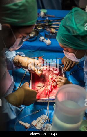 Kidney removal by laparoscopy from a living related donor, the surgeon retrieves and prepares the kidney stored in a cold solution while awaiting the Stock Photo