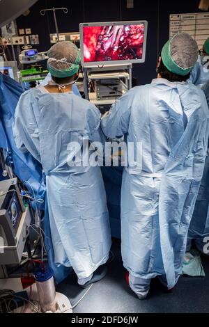 Kidney removal by laparoscopy from a living related donor, Bordeaux hospital, France. Stock Photo