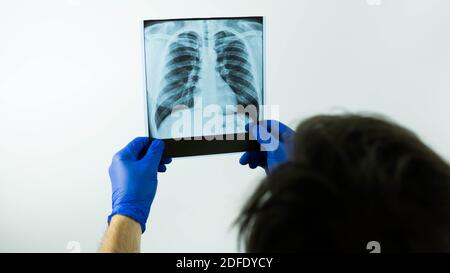 X-ray picture in the hands of a doctor on a white background, a medical worker looks at a picture of an X-ray of the human lungs. Stock Photo