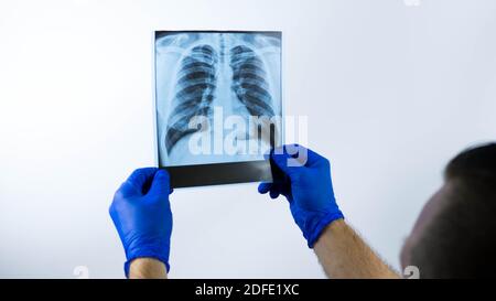 Medical radiography of thorax.Light background Stock Photo