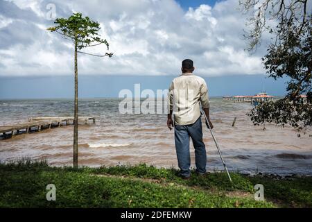 Disabled person paralyzed from Decompression sickness (DCS) due to intense lobster fishing using scuba diving methods looking at the ocean. Puerto Lempira, Mosquitia, Honduras Stock Photo