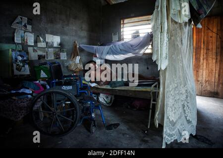 Disabled person paralyzed from Decompression sickness (DCS) due to intense lobster fishing using scuba diving methods, lying in his bed with a wheelchair next to him. Puerto Lempira, Mosquitia, Honduras Stock Photo