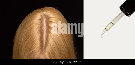 The woman's head on top, hair parted in the middle. Pipette cosmetics, skin care oil for hair. Stock Photo
