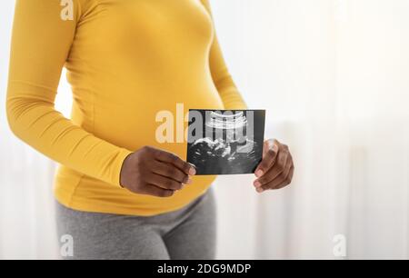 Unrecognizable pregnant woman holding ultrasound image of unborn child Stock Photo