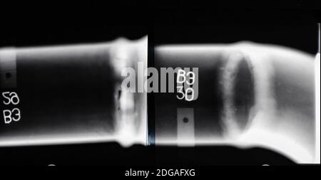 X-ray of a welded seam of the pipeline Stock Photo