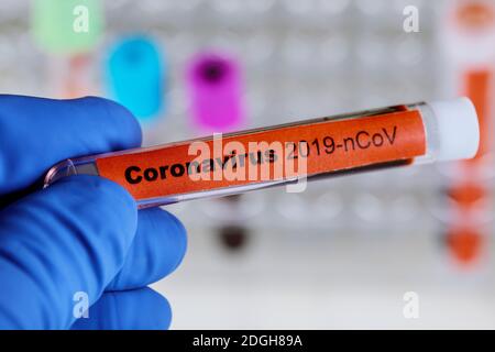 2019-nCoV Middle East respiratory syndrome coronavirus with blood sample Stock Photo