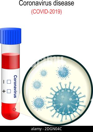 Coronavirus. 2019-nCoV acute respiratory disease. COVID-19. Corona virus icon. China pathogen respiratory infection. novel coronavirus pneumonia (NCP) Stock Vector