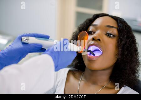 Close up of face of young African woman patient having dental treatment at dentist's office. Dentist using dental treatment with curing UV lamp. Tooth Stock Photo