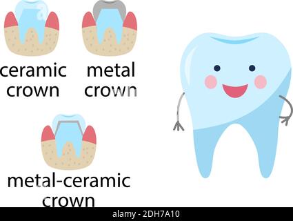 Service installation of a ceramic crown. As well as a metal and gold crown on the tooth. Happy healthy tooth character. Set icons flat style. Stock Vector