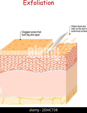 Exfoliation Is Removal Of The Old Dead Skin Cells On The Skin's Outer 