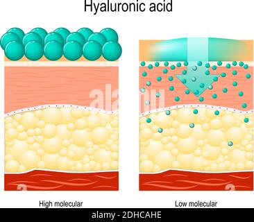 Hyaluronic acid. Hyaluronic acid in skin-care products. Low molecular and High molecular. Difference Stock Vector