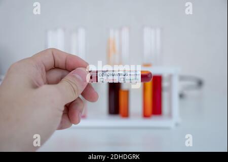 Hand holding sample of blood test tubes for diagnosis coronavirus, covid-19 infection at laboratory Stock Photo