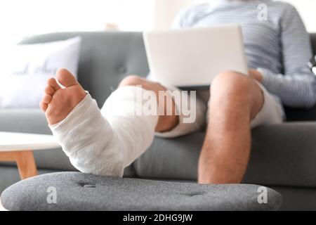 Young man with broken leg using laptop at home Stock Photo