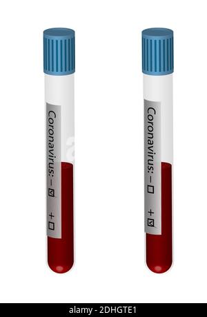 realistic test tubes with blood samples for coronavirus analyzes. Positive and negative result. Isolated vector on white background Stock Vector