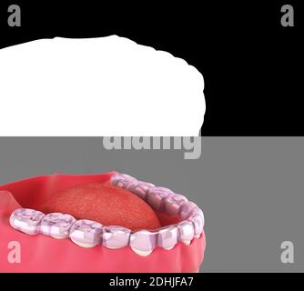 silicone braces on the display stand 3d render Alpha include Stock Photo