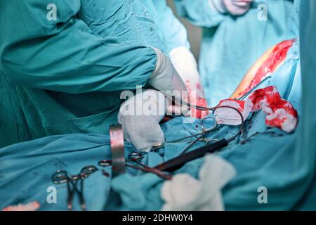 Physicians in Surgery looking down at patient Stock Photo