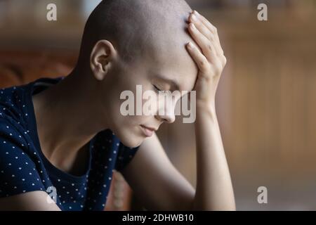 Close up sick hairless woman touch forehead, suffering from headache Stock Photo