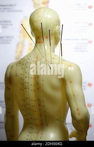 male acupuncture model with needles in the right shoulder Stock Photo