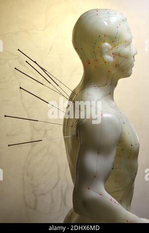 male acupuncture model with needles in the right shoulder Stock Photo