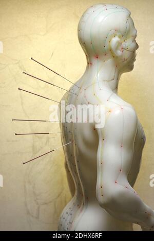 male acupuncture model with needles in the backbone Stock Photo