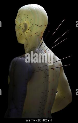 male acupuncture model with needles in the left shoulder against black background Stock Photo