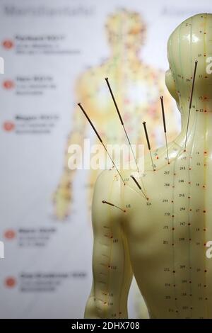 male acupuncture model with needles in the left shoulder Stock Photo