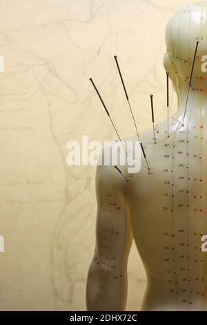 male acupuncture model with needles in the left shoulder Stock Photo