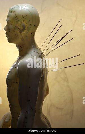 male acupuncture model with needles in the left shoulder Stock Photo